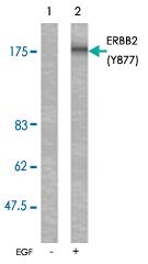 Anti-ERBB2 Rabbit Polyclonal Antibody