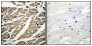 Antibody anti-SODIUM CHANNEL-PAN 100 µg