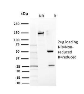 SDS-PAGE analysis of Anti-c-Kit Antibody [KIT/2669] under non-reduced and reduced conditions; showing intact IgG and intact heavy and light chains, respectively. SDS-PAGE analysis confirms the integrity and purity of the antibody