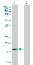 Anti-RTKN2 Mouse Polyclonal Antibody