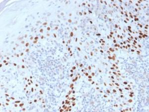 Immunohistochemical analysis of formalin-fixed, paraffin-embedded cervix using Anti-p40 Antibody