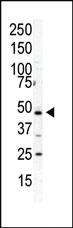 Anti-PIP4K2A Rabbit Polyclonal Antibody