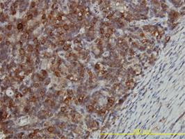 Anti-CCT5 Mouse Monoclonal Antibody [clone: 4E5-4B1]