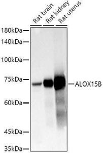 Western blot analysis of extracts of various cell lines, using Anti-15-LOX-2 Antibody (A12029) at 1:1,000 dilution The secondary antibody was Goat Anti-Rabbit IgG H&L Antibody (HRP) at 1:10,000 dilution Lysates/proteins were present at 25 µg per lane