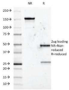 SDS-PAGE analysis of Anti-CD5 Antibody [B-B8] under non-reduced and reduced conditions; showing intact IgG and intact heavy and light chains, respectively SDS-PAGE analysis confirms the integrity and purity of the antibody