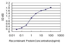 Anti-MPHOSPH10 Mouse Monoclonal Antibody [clone: 1B10]