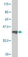 Anti-SUPT16H Mouse Monoclonal Antibody [clone: 1D12]