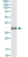 Anti-PNMT Antibody Pair