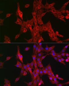 Immunofluorescence analysis of PC-12 cells using Anti-15-LOX-2 Antibody (A12029) at a dilution of 1:100 (40x lens) DAPI was used to stain the cell nuclei (blue)