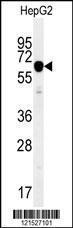 Anti-IGF2BP2 Rabbit Polyclonal Antibody