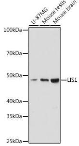 Anti-LIS1 Rabbit Monoclonal Antibody [clone: ARC2075]