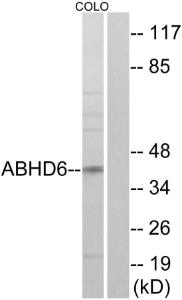 Western blot analysis of lysates from COLO cells using Anti-ABHD6 Antibody The right hand lane represents a negative control, where the antibody is blocked by the immunising peptide