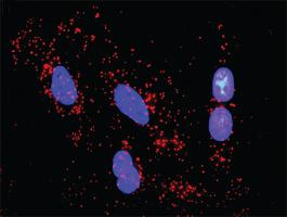 Anti-PTK2B Antibody Pair