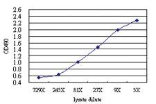 Anti-GLB1 Antibody Pair