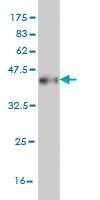 Anti-CPS1 Mouse Monoclonal Antibody [clone: 8H8]