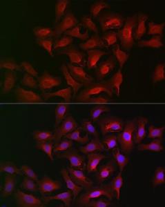 Immunofluorescence analysis of U2OS cells using Anti-15-LOX-2 Antibody (A12029) at a dilution of 1:100 (40x lens) DAPI was used to stain the cell nuclei (blue)