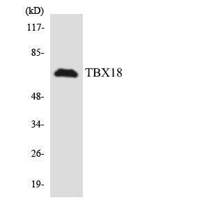 Western blot analysis of the lysates from HT 29 cells using Anti-TBX18 Antibody