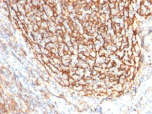 Immunohistochemical analysis of formalin-fixed, paraffin-embedded human tonsil dendritic using Anti-CD21 Antibody [CR2/2754]