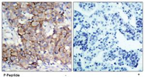 Anti-ERBB2 Rabbit Polyclonal Antibody