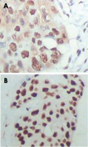 Anti-HDAC3 Mouse Monoclonal Antibody [clone: 3A7B5]