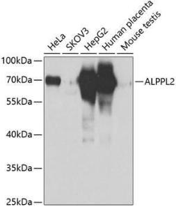 Western blot analysis of extracts of various cell lines, using Anti-ALPPL2 Antibody (A12030) at 1:1,000 dilution