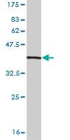 Anti-SUPT16H Mouse Monoclonal Antibody [clone: 2D1]