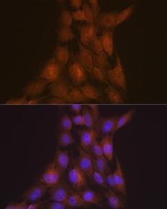 Anti-LIS1 Rabbit Monoclonal Antibody [clone: ARC2075]