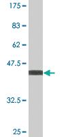 Anti-NME6 Mouse Monoclonal Antibody [clone: 2A10]