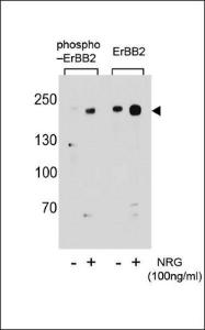 Anti-ERBB2 Rabbit Polyclonal Antibody