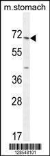 Anti-ESCO2 Rabbit Polyclonal Antibody (AP (Alkaline Phosphatase))