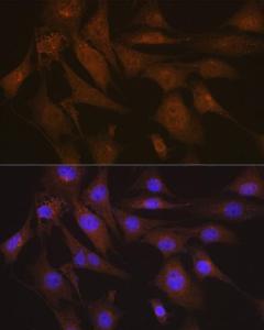 Anti-LIS1 Rabbit Monoclonal Antibody [clone: ARC2075]