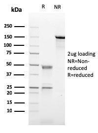 SDS-PAGE analysis of Anti-CD21 Antibody [CR2/2754] under non-reduced and reduced conditions; showing intact IgG and intact heavy and light chains, respectively. SDS-PAGE analysis confirms the integrity and purity of the Antibody