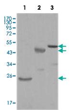 Anti-KARS Mouse Monoclonal Antibody [clone: 8G12C1]