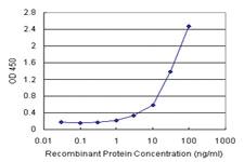 Anti-TSC22D3 Antibody Pair