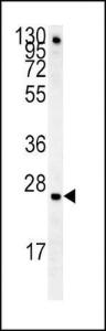 Anti-IGFBP4 Rabbit Polyclonal Antibody (PE (Phycoerythrin))