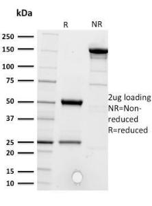 SDS-PAGE analysis of Anti-CD5 Antibody [CD5/2416] under non-reduced and reduced conditions; showing intact IgG and intact heavy and light chains, respectively. SDS-PAGE analysis confirms the integrity and purity of the Antibody