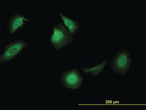 Anti-CCT5 Mouse Monoclonal Antibody [clone: 4E5-4B1]