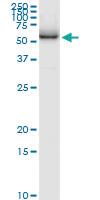 Anti-ATP6V1H Polyclonal Antibody Pair