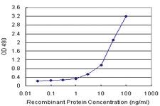 Anti-TSC22D3 Polyclonal Antibody Pair