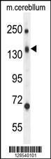 Anti-CD109 Rabbit Polyclonal Antibody (PE (Phycoerythrin))