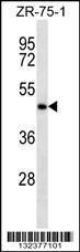 Anti-IGHE Rabbit Polyclonal Antibody (AP (Alkaline Phosphatase))