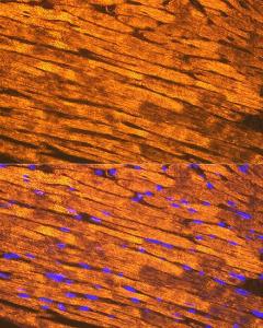 Immunofluorescence analysis of mouse heart using Anti-Tropomyosin 1 (alpha) Antibody [ARC1283] (A306724) at a dilution of 1:100 (40X lens). DAPI was used to stain the cell nuclei (blue)