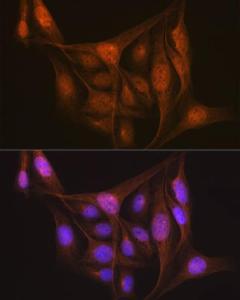 Anti-LIS1 Rabbit Monoclonal Antibody [clone: ARC2075]