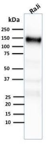 Western blot analysis of human Raji cell lysate using Anti-CD21 Antibody [CR2/2754]