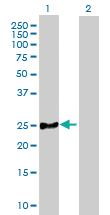 Anti-MRPL21 Mouse Polyclonal Antibody