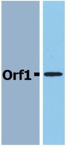 Western Blotting analysis (reducing conditions) of recombinant protein Orf1 in cell lysate of Orf1-transfected E. coli using Anti-Orf1 / FrpD Antibody (A85768)