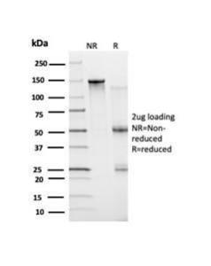 SDS-PAGE analysis of Anti-Bcl-6 Antibody [PCRP-BCL6-1D3] under non-reduced and reduced conditions; showing intact IgG and intact heavy and light chains, respectively. SDS-PAGE analysis confirms the integrity and purity of the Antibody