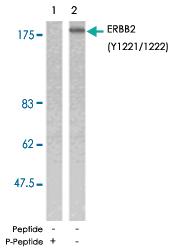 Anti-ERBB2 Rabbit Polyclonal Antibody