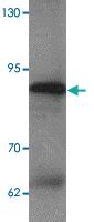 Anti-EZH2 Rabbit Polyclonal Antibody