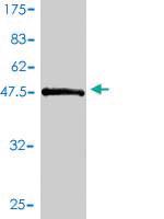 Anti-LAT Mouse Monoclonal Antibody [clone: 3B11-1D5]